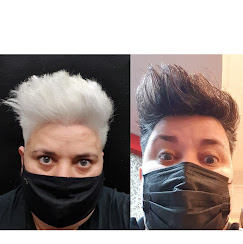 Antes y después tratamiento capilar